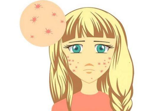 吃瓜不长痘,揭秘健康饮食与美丽肌肤的完美结合